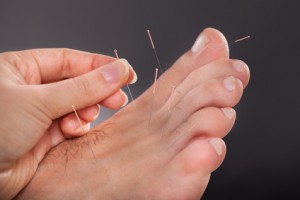 Akupunktur am Fußrücken gegen Migräne